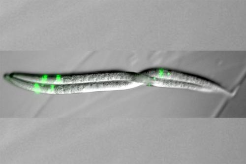 Chromosomes (dat-1::gfp)