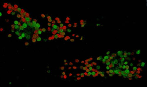 ric-4 (green) ; rab-3 (red)